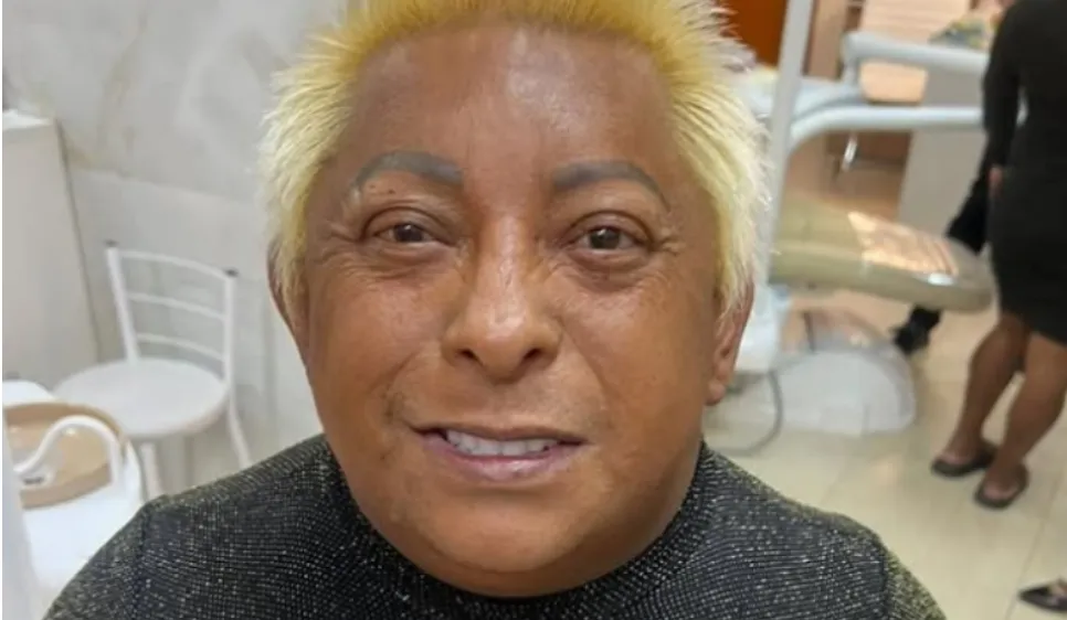 Patixa Teló exibe novo sorriso após cirurgia de implantes em Goiânia; veja resultado